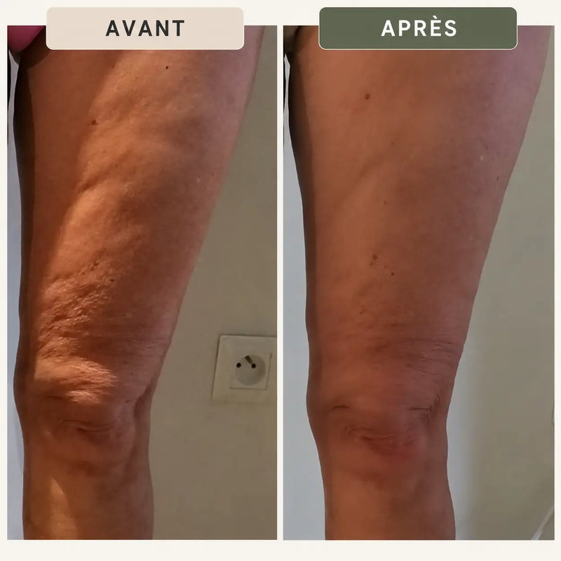Résultat client