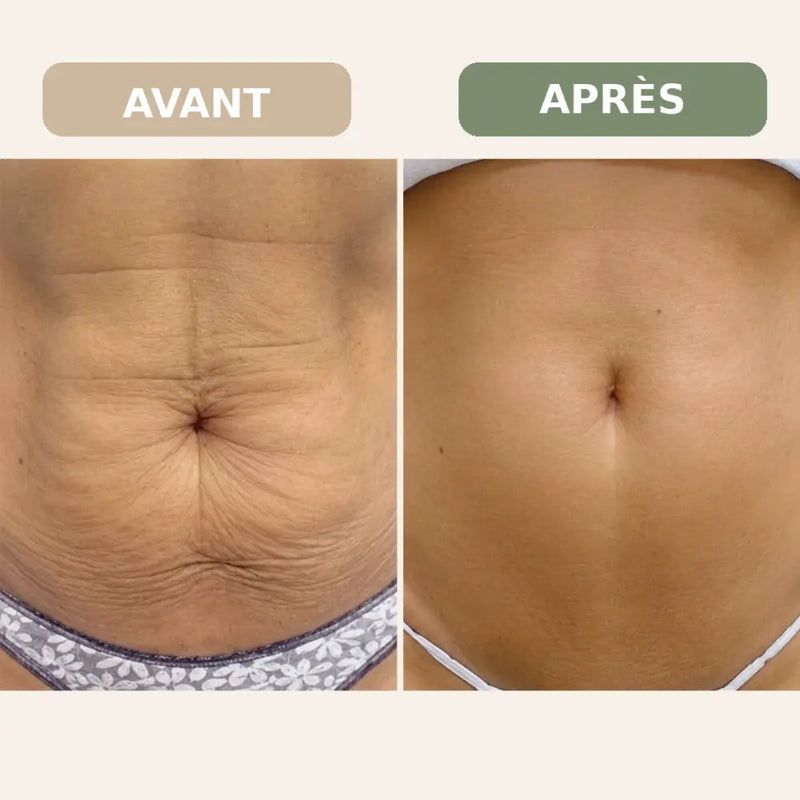 Résultat client