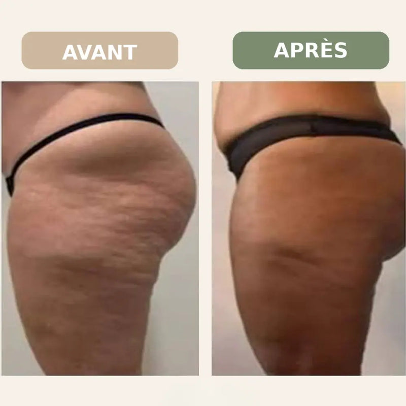 Résultat client